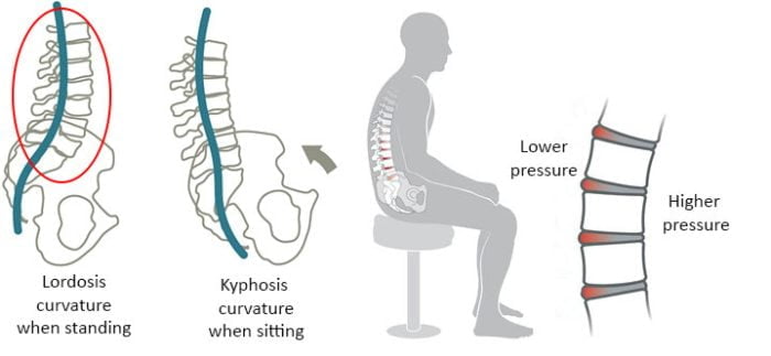 Breaking Back - What actually happens when you sit? - Karo